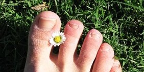 Pilzbefall der Fußnägel