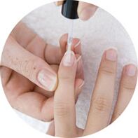 Tragen Sie Nagellack auf, um Nagelpilz zu behandeln